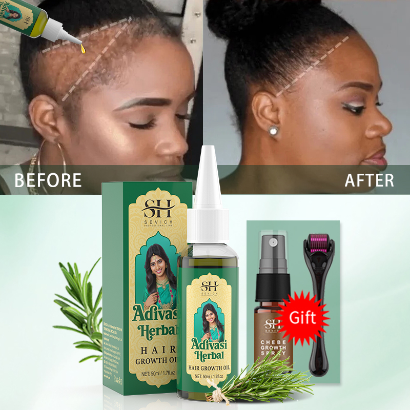 Ayurvedic Hair Growth Oil Indi - Hair Care Essence Oil Spray review and price