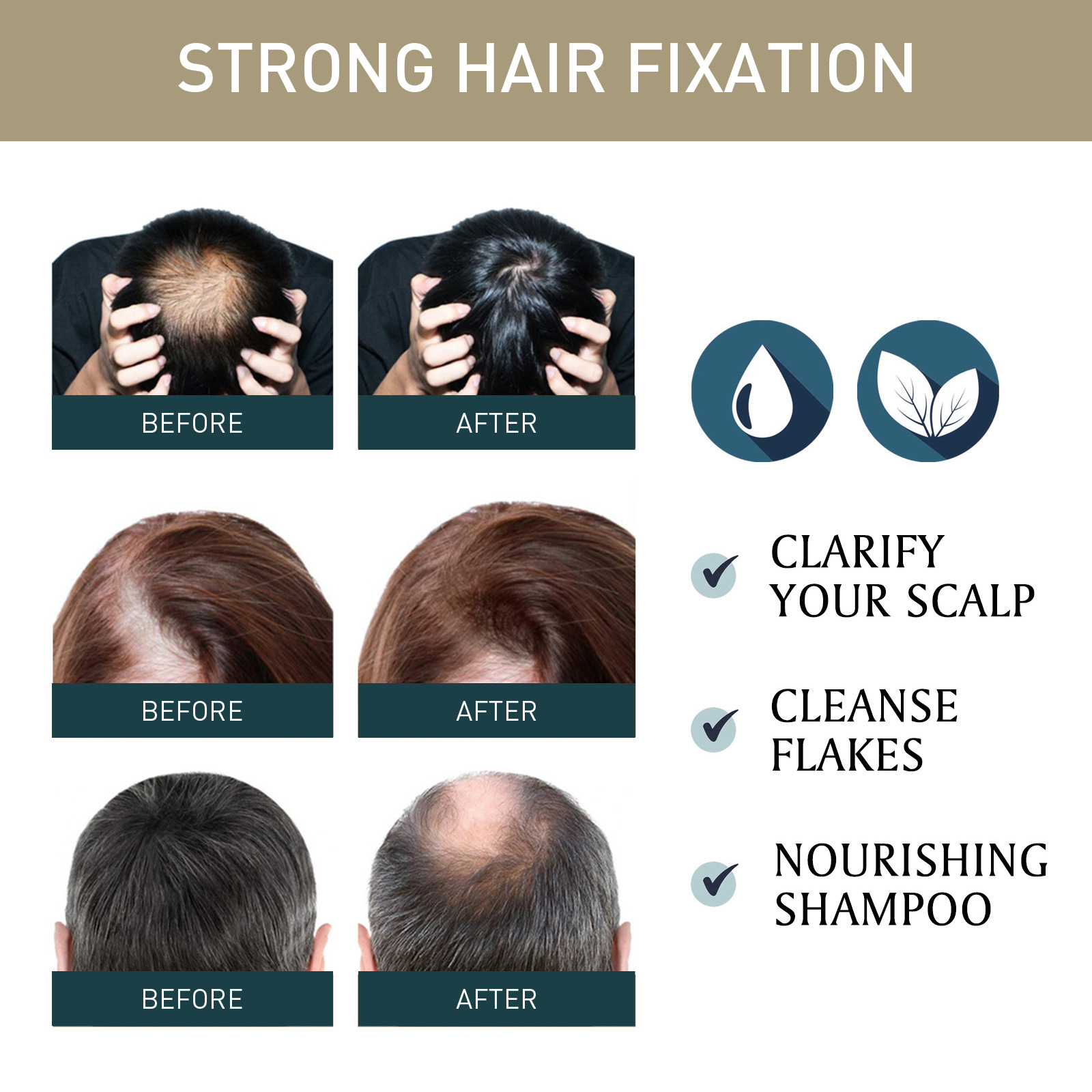2pcsx100ml Hair Growth Shampoo - Hair Care Natural Ingredients review and price