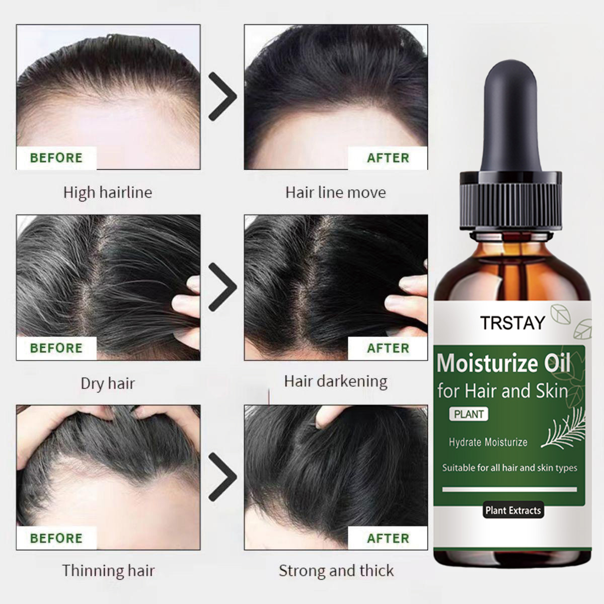 TRSTAY Rosemary Essential Oil  - Rosemary Hair Oil review and price