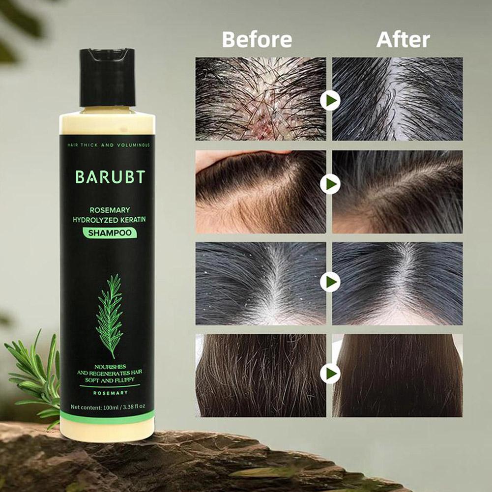 Rosemary Shampoo Hair Growth D - Rosemary Hair Oil review and price