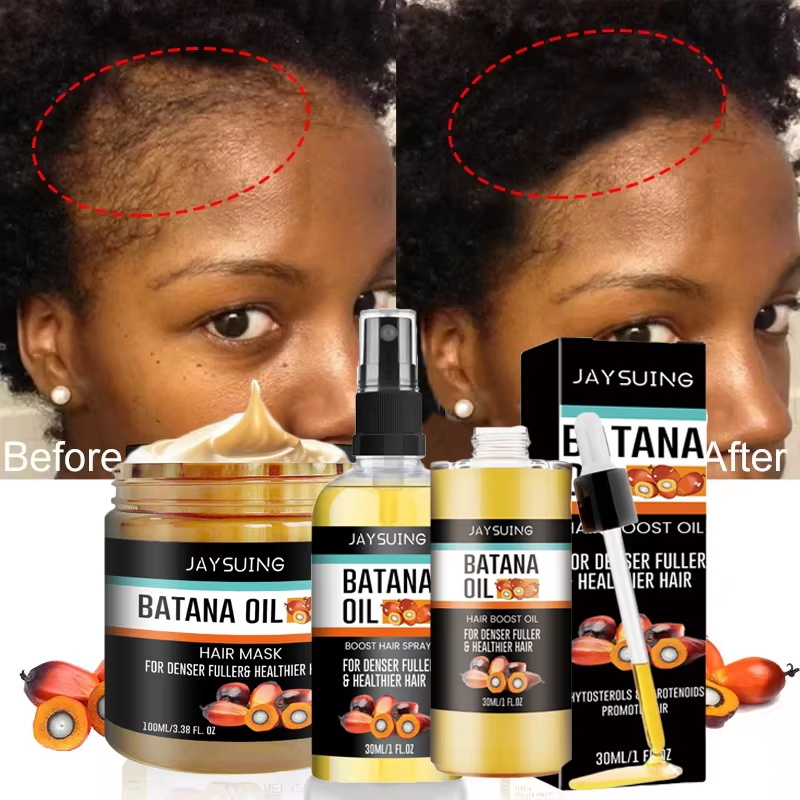 Batana Oil Thick Hair Serum Sp - Hair Care Essence Oil Spray review and price