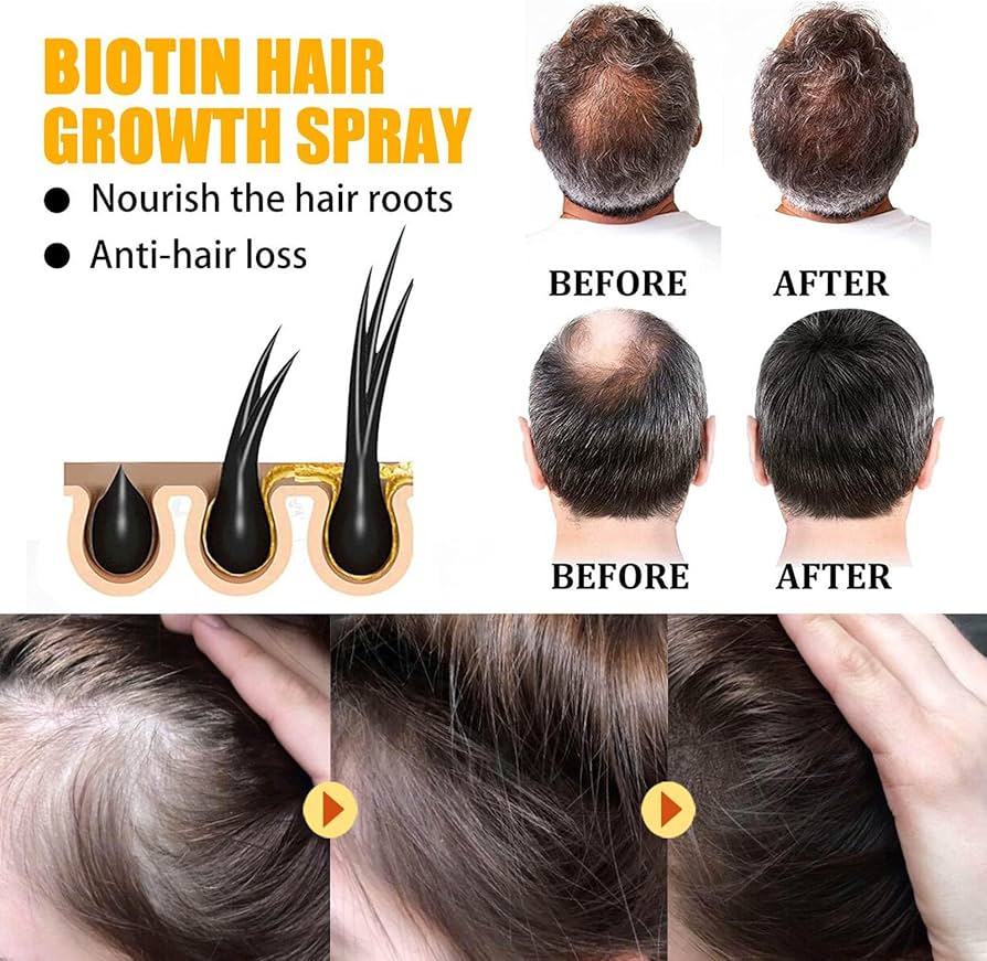 Batana Oil Thick Hair Serum Sp - Hair Care Essence Oil Spray review and price