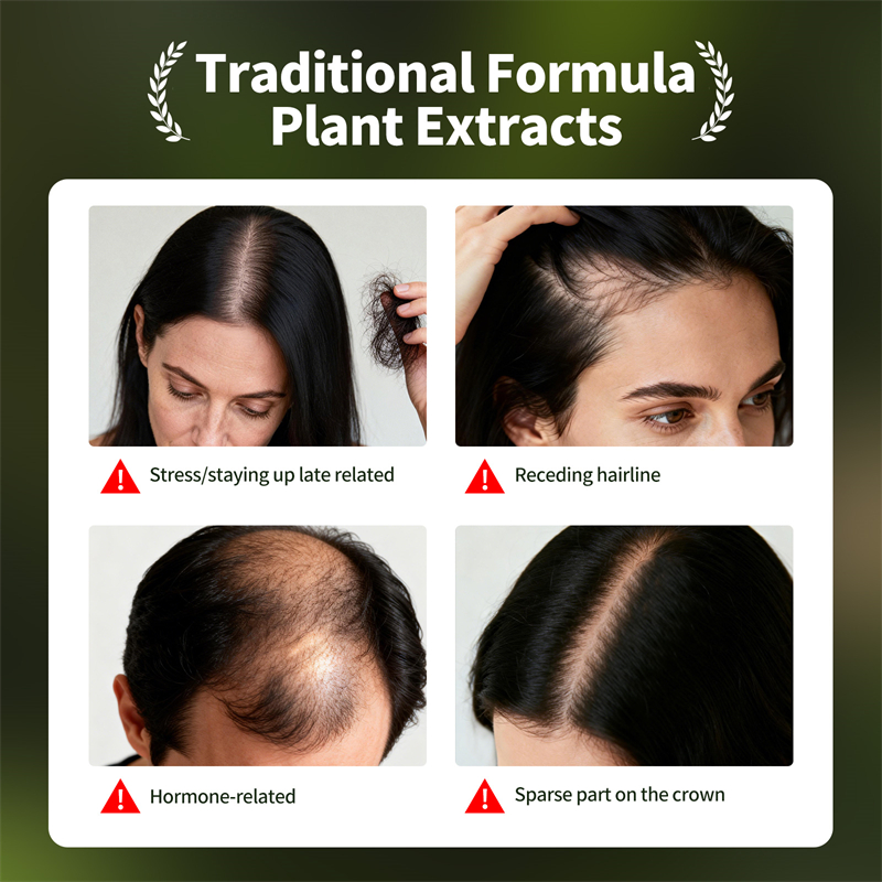 Natural Hair Growth Set Usman  - Hair Care Essence Oil Spray review and price