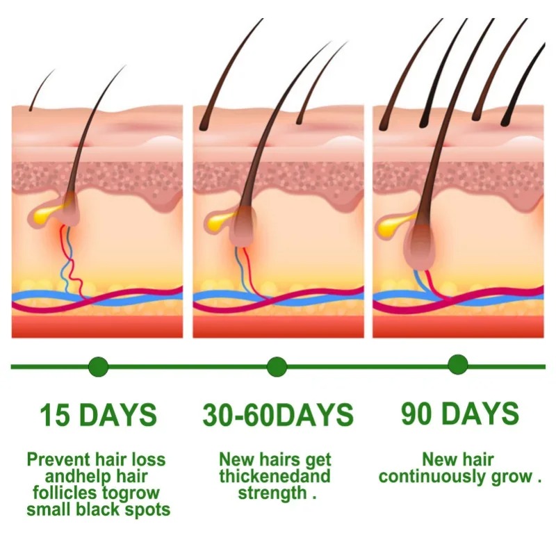 Hair Growth Serum Fast Growing - Hair Care Essence Oil Spray review and price
