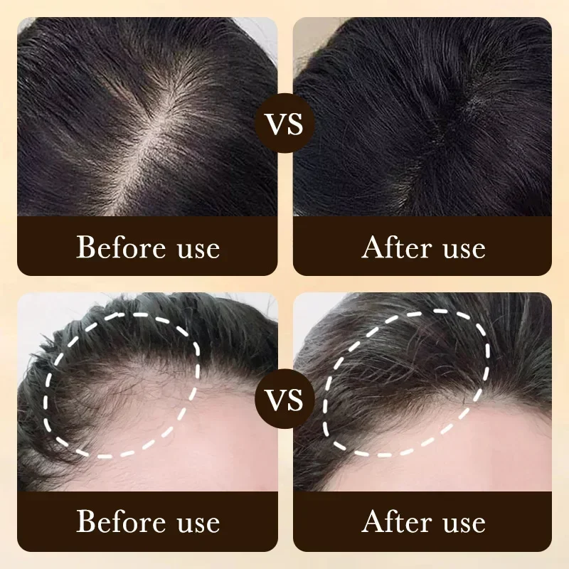 Biotin Fast Hair Growth Oil Pr - Hair Care Essence Oil Spray review and price