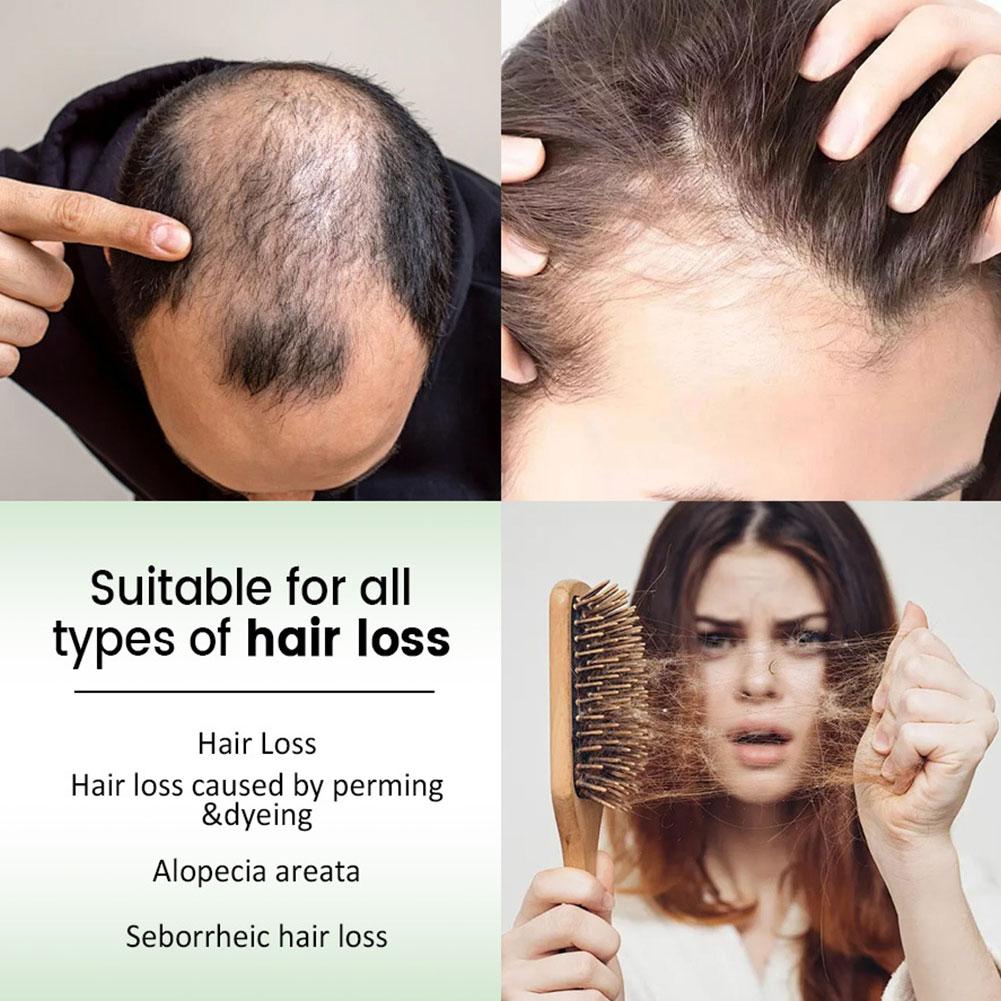 1/2pcs Rosemary Hair Shampoo V - Rosemary Hair Oil review and price
