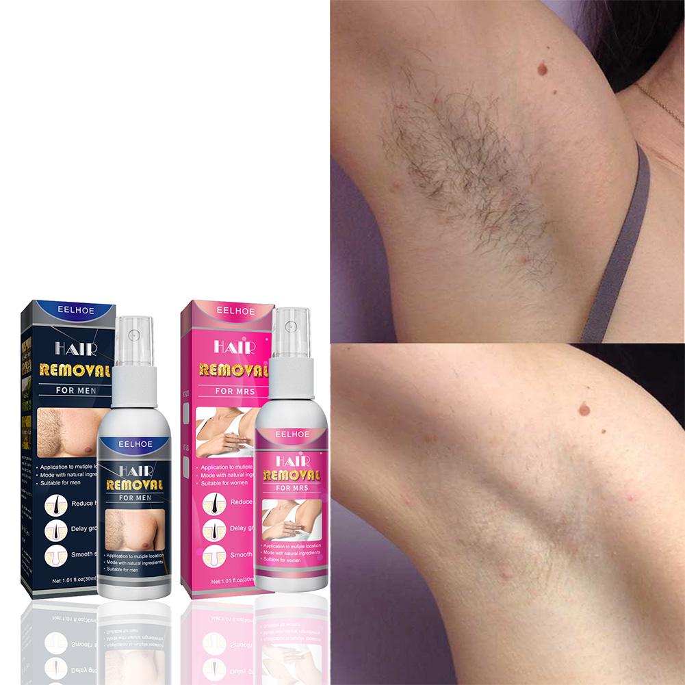 1/2PCS Super Natural Painless  - Hair Care Lotion review and price