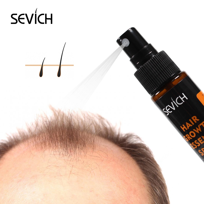 Sevich 30ml Hebal Oil Essence  - Hair Care Essence Oil Spray review and price